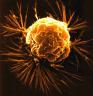 Cancer Kills A Lot More People Than You Think